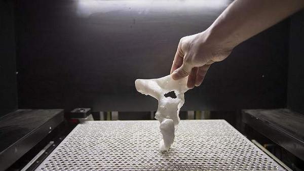 创想三维：3D打印机制造模型如何改善骨折治疗