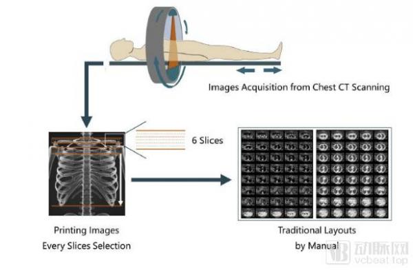 用AI重塑影像工作流：柳叶刀子刊 EBiomedicine发表南京鼓楼医院与推想科技最新成果
