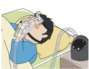 质量流量传感器模块在CPAP呼吸机中具有调节气流控制的作用