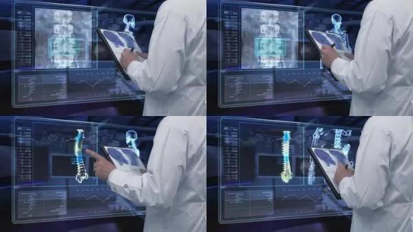 陈根：可自行检查的X光设备，高效检查及时就医