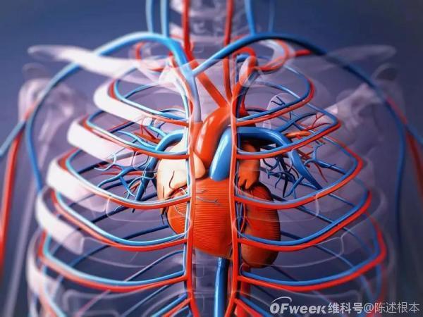 陈根：人造动脉瓣原型装置，为心脏减压