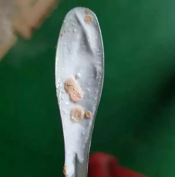 的勺子就会长出如下图样的"汞斑",下图示的产品含4%的氯化氨基汞